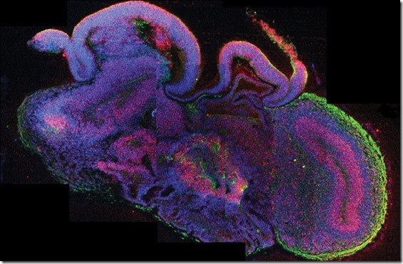 mini cerebro thumb Cientistas crescem cérebros humanos em laboratório