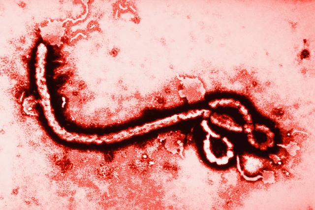 ebola Cientista britânico afirma que vírus Ebola tem origem extraterrestre